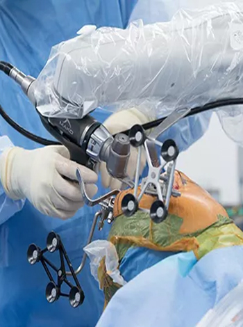 Robotic Knee Replacement Surgery