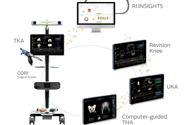 Robotic Knee Replacement