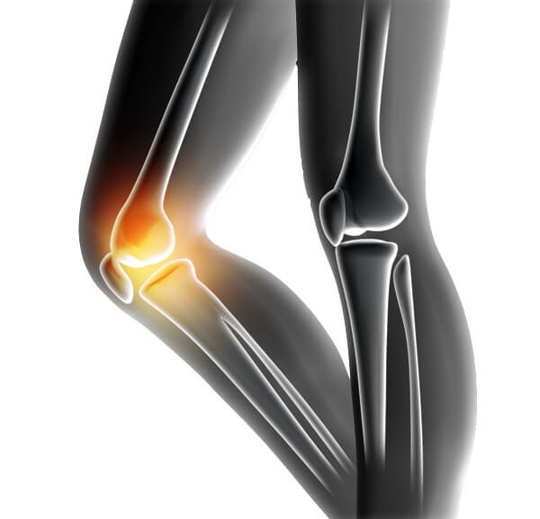 Top Knee Joint Replacement Surgery hospital in Rajasthan