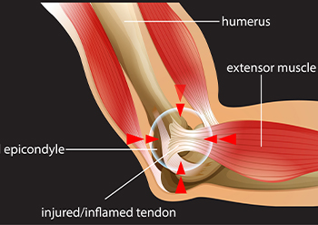 hip replacement surgeon/doctor in ahmedabad, gujarat