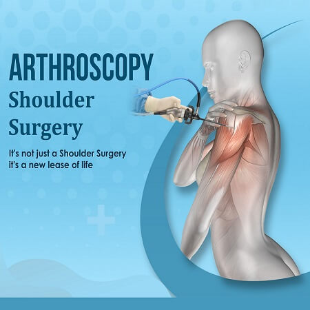 best Arthroscopy doctor/surgeon specialist surgery hospital in Ahmedabad