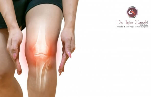 best knee replacement specialist surgery hospital, surgeon in ahmedabad